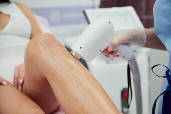 Лазерная эпиляция: Открытие долгосрочной красоты и успеха в мире франшиз