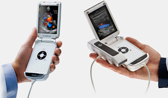 Портативные УЗИ аппараты: Новый взгляд на медицинскую диагностику